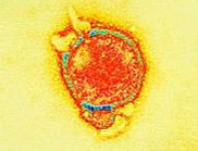 Hendra virus Hendra virus